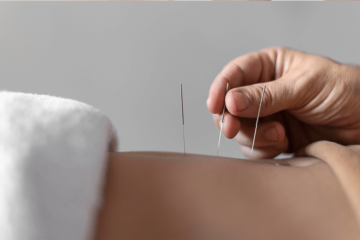 Acupuncture by Healthy Choice Clinic